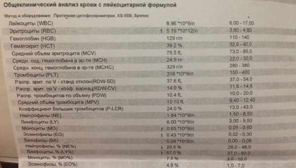 У ребенка повышены тромбоциты