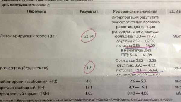 Анализы при планировании беременности – список