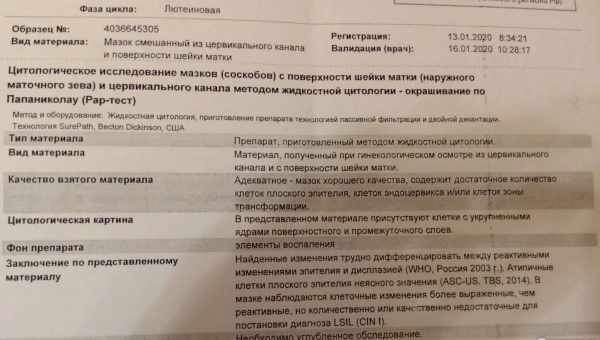 Удаление вирусной программы Uncheckit