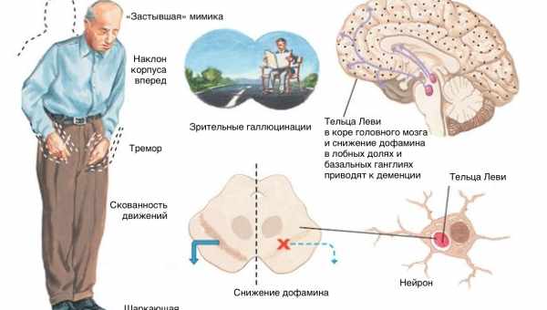 Нарушение работы дофаминергических нейронов связали с антисоциальностью при аутизме