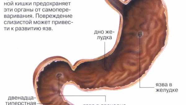 Синюха в борьбе с язвой желудка и двенадцатиперстной кишки