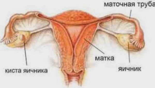 Спайки и спаечная болезнь – причины, признаки, методы диагностики