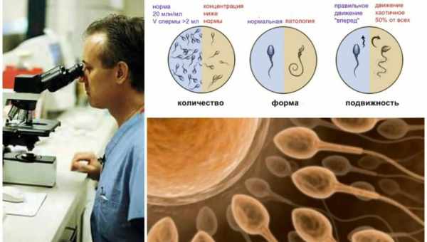 Спермограмма тест