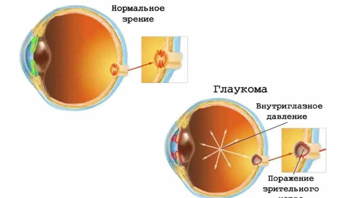 Лазер и микробный белок вживили зрительные образы в мозг мышей