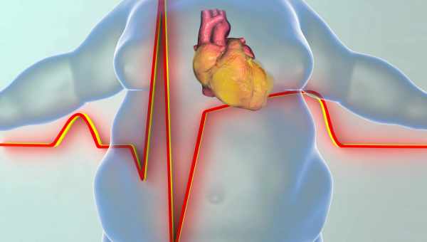 Жир на животе связали с повторным сердечным приступом